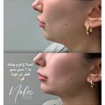کلینیک زیبایی و لیزر مو زائد نوبا