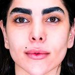 دکتر زیبایی علیرضا قاسمی