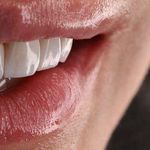 دندانپزشکی و ایمپلنت دکتر مهدی کریمی