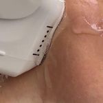 کلینیک لاغری، هایفو تراپی دکتر پوران