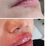 کلینیک پوست مو و لیزر و زیبایی بهرویان