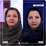 کلینیک پوست مو و زیبایی نوین ایرانا