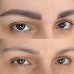 مرکز تخصصی فیبروز ابرو مژگان خناری