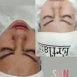خدمات تخصصی پاکسازی پوست و فیشال مهسا