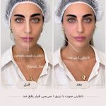 مرکز لیزر ،پوست و زیبایی کندی بیوتی