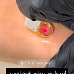 مطب پوست زيبايی ليزر دکتر شاه نعمت الهی