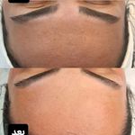 خدمات تخصصی پوست و فیشال سمانه ابراهیمی