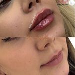 مرکز لیزر ، ژل ، فیلر  بوتاکس کلینیک بلا