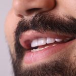 کلینیک دندانپزشکی برکه(قرارداد به بیمه)