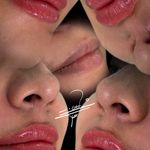 مطب پوست زيبايی ليزر دکتر شاه نعمت الهی