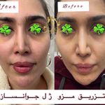 کلینیک پوست و زیبایی ولاغری تاج عظیمیه