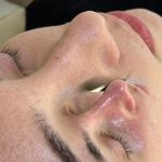 فیشیال / خدمات پوست / سالن زیبایی