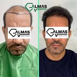 کلینیک پوست،زیبایی ولیزر وکاشت مو الماس