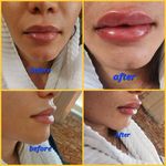 کلینیک زیبایی بوتاکس لیزر فیلر شجاعی