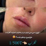 مرکز لیزر و کلینیک زیبایی پریفا