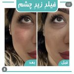 کلینیک لیزر و زیبایی لیلیا