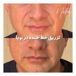 کلینیک زیبایی و لیزر مو زائد نوبا