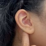 کلینیک شنوایی سنجی دورمی