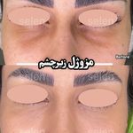 کلینیک زیبایی و لیزر سلن مشهد