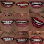 دندانپزشکی تخصصی سرینا