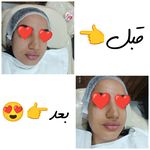 مراقبت پوست زهرا جابری