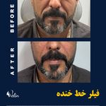 کلینیک زیبایی و جوانسازی پوست و مو الین