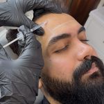 مطب پوست، مو و زیبایی و لیزر شبیرا