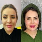 کلینیک پوست سلین - کلینیک پوست و مو - شهر شیراز - 0030
