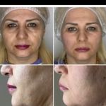 کلینیک زیبایی دکتراحمدقدیانفر