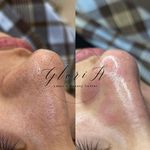 کلینیک زیبایی گلوریا