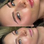 مرکز میکروبلیدینگ وفیبروز فرشته تقی زاده