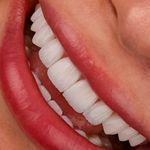کلینیک‌دندانپزشکی دنتال آرنا-بیمه نیستیم