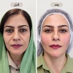 مرکز تخصصی پوست و مو و لیزر حس