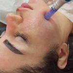 سالن تخصصی فیشال و پاکسازی پوست دریا