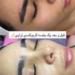 مژگان اسکین کرMojgan skincare