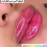 کلینیک لیزر و زیبایی مهسان