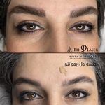 خدمات تخصصی ریمو تتو آزیتا