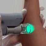 کلینیک زیبایی،مرکز لیزر الکساندرایت تاژا