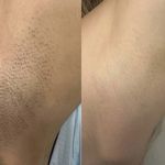 مطب پوست، مو و زیبایی و لیزر شبیرا