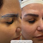 کلینیک زیبایی الینا رز