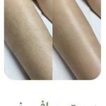 مطب پوست، مو و زیبایی و لیزر شبیرا