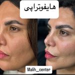 کلینیک لیزر و  زیبایی ملیح