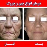 درمان تخصصی انواع عارضه پوست و مو