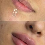 کلینیک زیبایی کهربا قرچک
