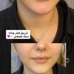 کلینیک زیبایی فریحا(پوست و مو)