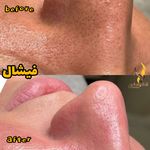 کلینیک زیبایی و مرکز لیزر هانیسا