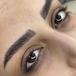 میکروبلیدینگ و شیدینگ لب محدثه