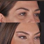 کلینیک زیبایی الماس کاملا اقساطی