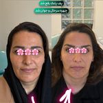 کلینیک زیبایی و لیزر دکتر آزاده اسماعیلی