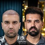 کلینیک پوست مو و زیبایی نوین ایرانا